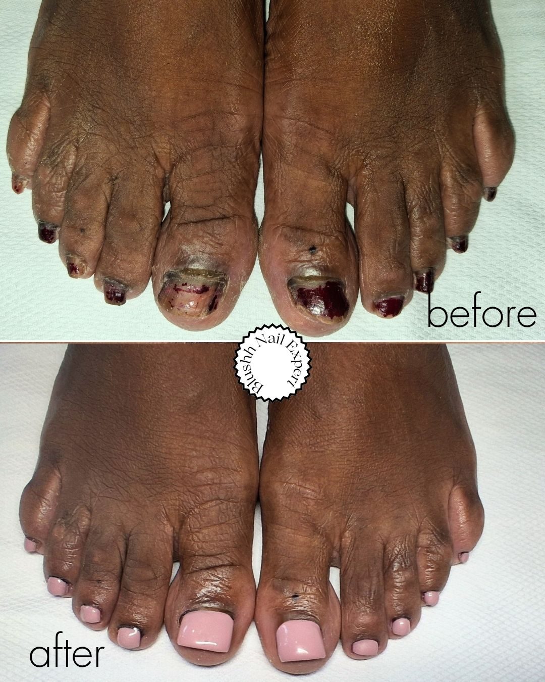 Before and after — severe trauma recovered with soft pink luxury finish