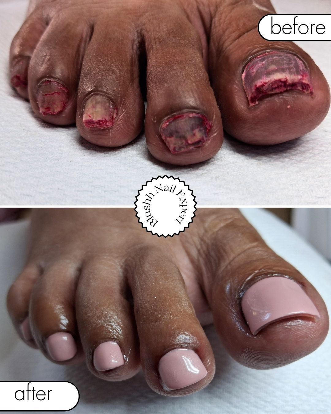 Before and after — damaged nails reconstructed to a clean nude finish
