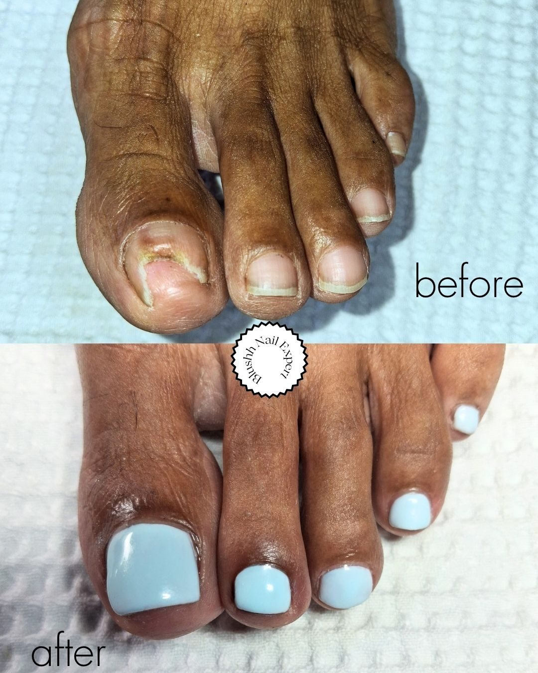 Before and after — fungal damage corrected with a clean light blue finish