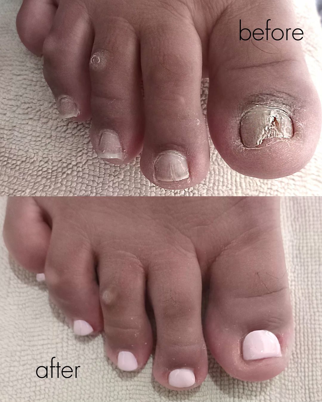 Before and after — yellowed nails refreshed with a clean pink polish