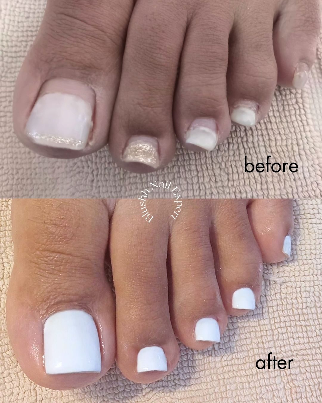 Before and after — damaged nail structure rebuilt with a bold blue finish
