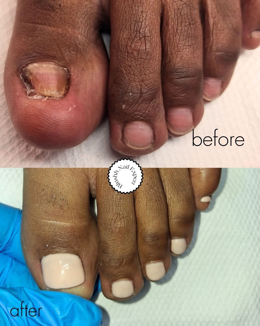 Before and after — swollen inflamed toe restored to a clean off-white finish