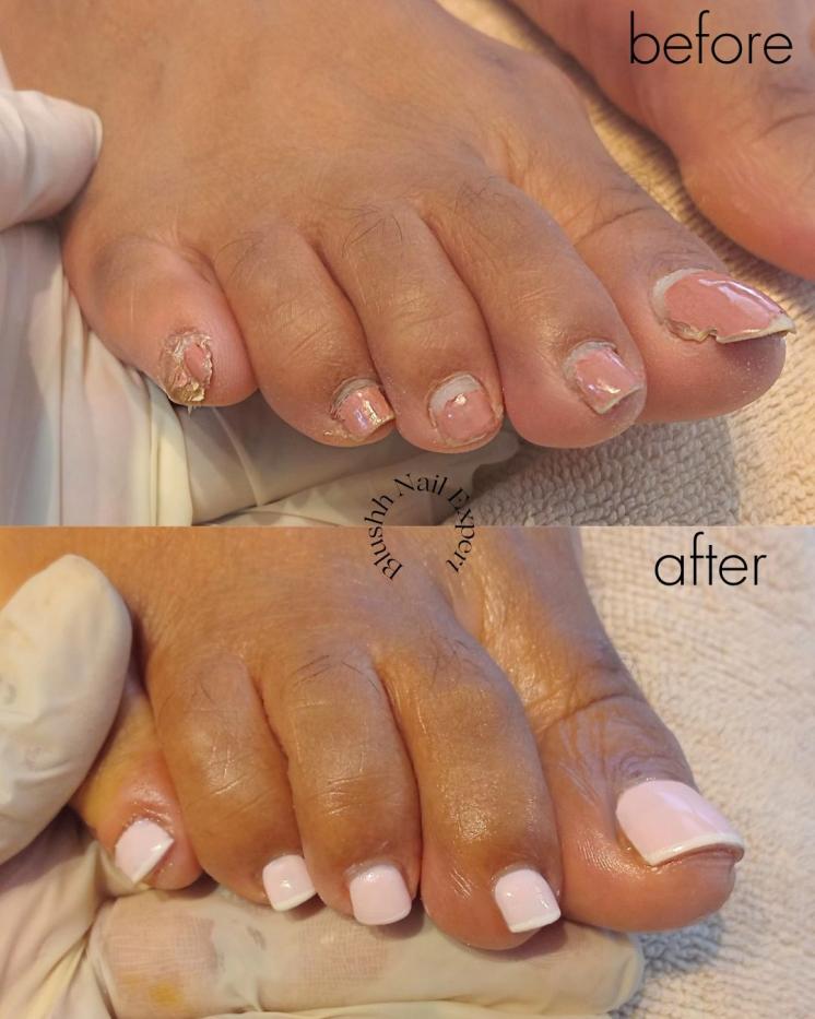 Before and after — peeling fragile nails to clean structured perfection